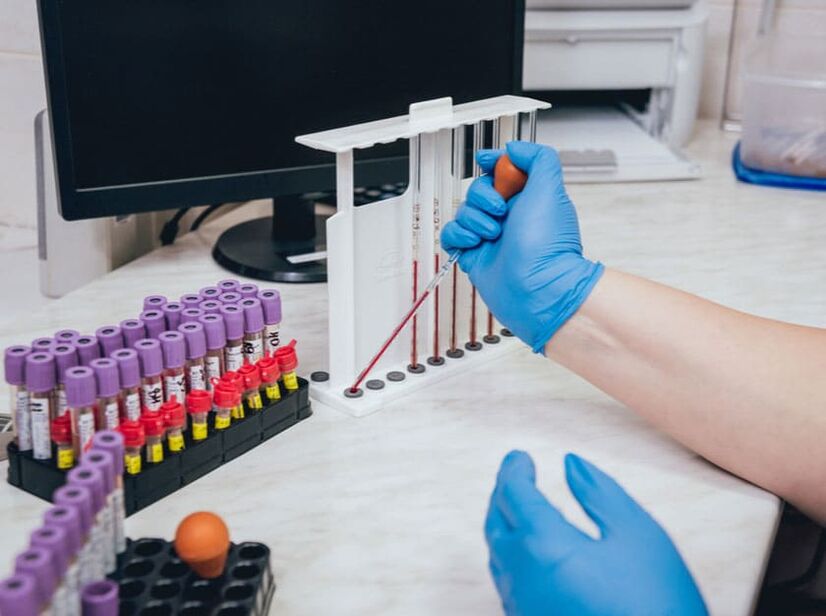 Test blood sugar after drinking alcohol